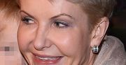 Joanna Racewicz: Jej twarz to maska! Jest coraz gorzej!