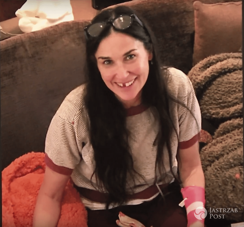 Demi Moore bez zęba