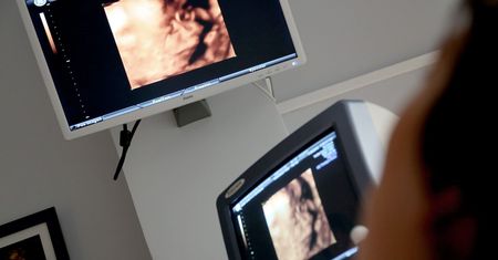 Pacjentka w ciąży zgłaszała ledwo wyczuwalne ruchy dziecka, a lekarz nie wykonał badań. Odpowie za narażenie dziecka na bezpośrednie niebezpieczeństwo utraty życia lub ciężkiego uszczerbku na zdrowiu