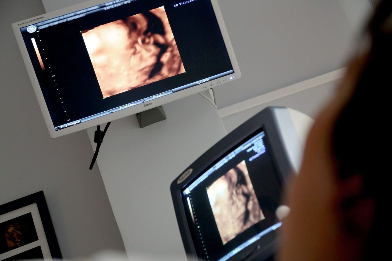 Pacjentka w ciąży zgłaszała ledwo wyczuwalne ruchy dziecka, a lekarz nie wykonał badań. Odpowie za narażenie dziecka na bezpośrednie niebezpieczeństwo utraty życia lub ciężkiego uszczerbku na zdrowiu