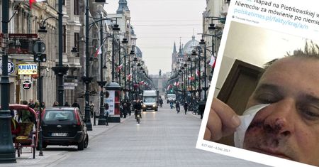 Pobili Niemców za mówienie po niemiecku. Ofiary napadu czekają na operacje