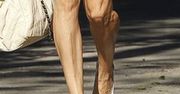 Ona ma najbrzydsze nogi świata?
