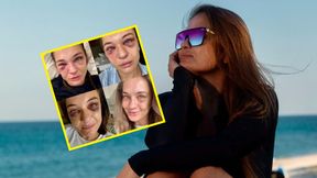 Minął tydzień od walki. Tak wygląda twarz Kowalkiewicz