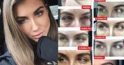 Deynn pokazała siniaki po "operacji worów"... Teraz jest lepiej? (FOTO)