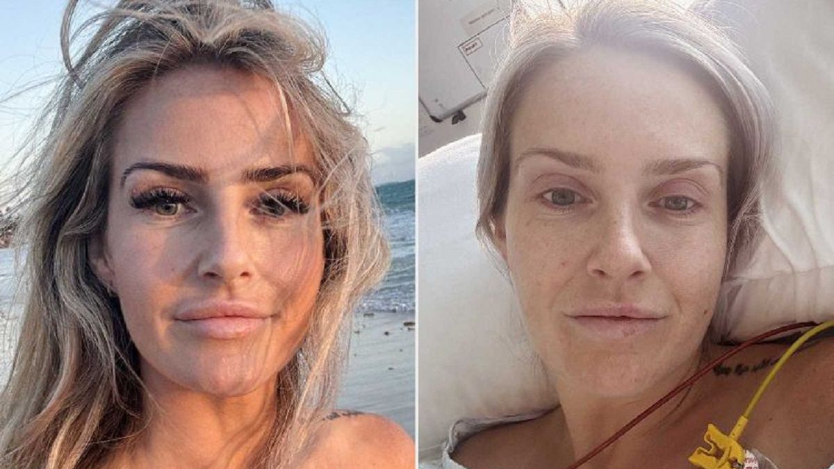 Odkładała badanie przez wstyd