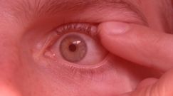 Viagra zniszczyła mu wzrok