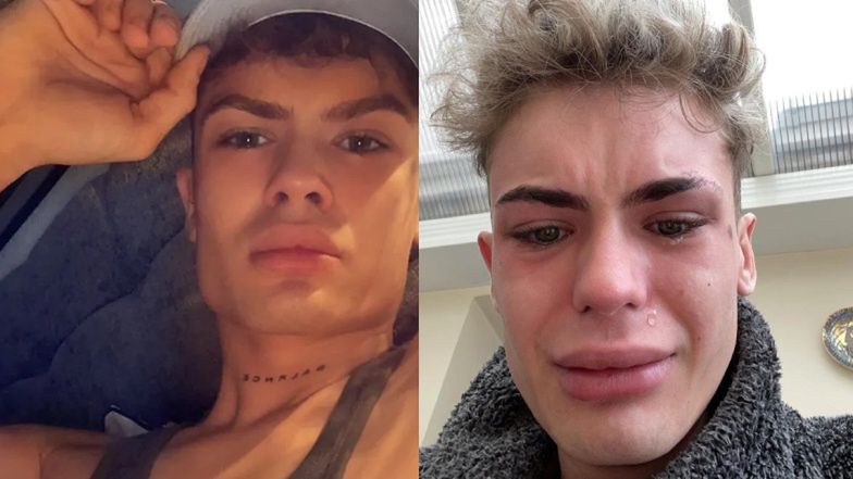 Influencer zrobił sobie zęby w Turcji: "Wyglądam jak rekin"