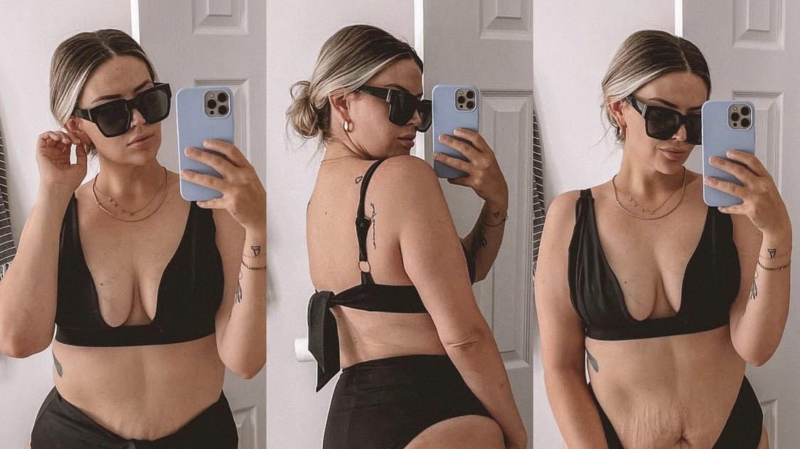 Odważyła się pokazać ciało po ciąży bez filtrów na Instagramie