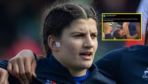 Skandaliczne zachowanie Francuzki. Oto kara za ugryzienie rywalki