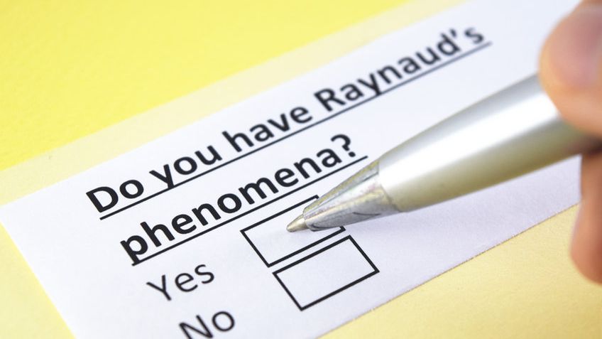 Objaw Raynauda to zaburzenie naczynioruchowe, które charakteryzuje się nadmiernym wychłodzeniem dłoni i stóp