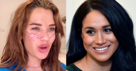 Niebezpieczny trend z TikToka. Chciały upodobnić się do Meghan Markle
