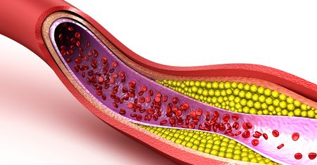 Produkty, które mają najwięcej złego cholesterolu