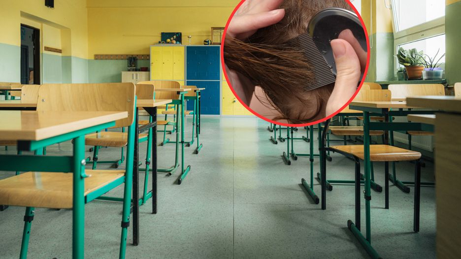 W szkołach i przedszkolach atakuje wszawica