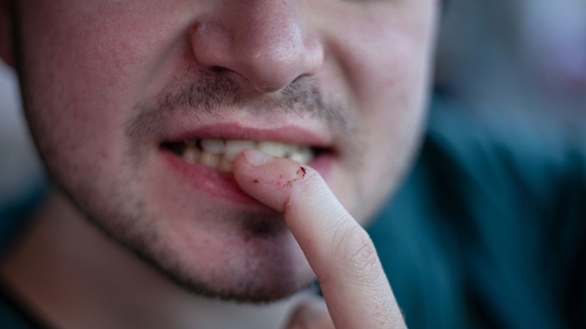 Obgryzanie skórek często występuje na tle nerwowym i pojawia się w wyniku sytuacji stresowych