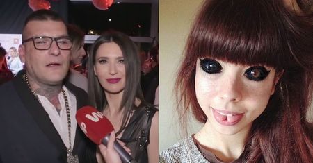 Popek do fanki z wytatuowanymi gałkami: "Mam nadzieję, że ślepota się cofnie. Wracaj do zdrowia!"