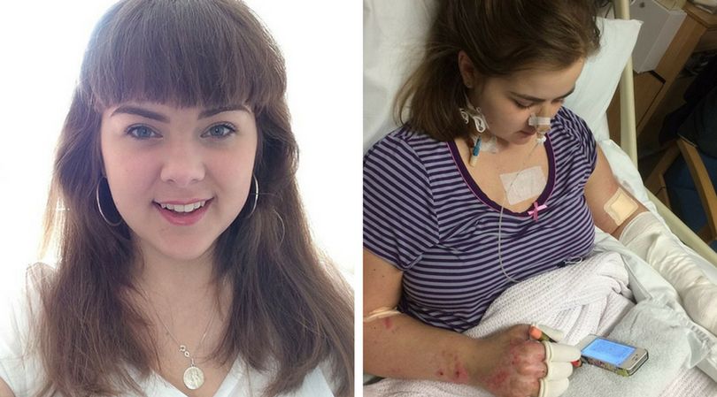 21-letnia Charlotte Hannibal w wyniku doznania zapalenia opon mózgowych, została trwale niepełnosprawna 