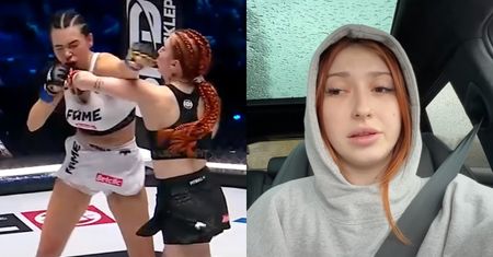 Murcix prezentuje POTURBOWANĄ TWARZ po przegranej z eks Mini Majka na Fame MMA. Internauci: "LEKCJA POKORY" (FOTO)