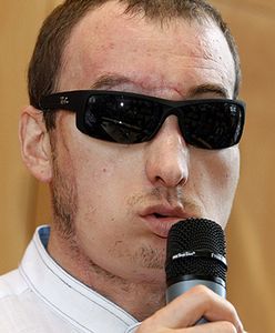 Pierwszy wywiad mężczyzny z przeszczepioną twarzą: modliłem się za dawcę