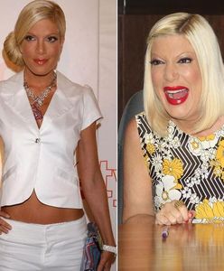 Tori Spelling: Jej twarz ewoluuje!