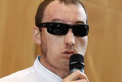 Pierwszy wywiad mężczyzny z przeszczepioną twarzą: modliłem się za dawcę