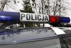 Rowerzysta oblał mężczyznę żrącą substancją. 77-latek doznał ciężkich poparzeń