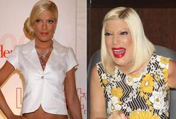 Tori Spelling: Jej twarz ewoluuje!
