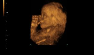 Rzecznik Praw Obywatelskich ws. odwołania od odmowy wykonania aborcji