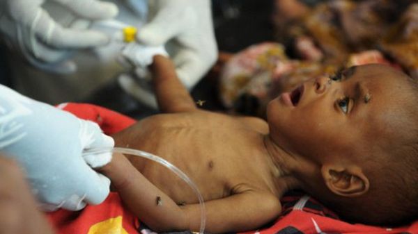 Pół miliona dzieci już cierpi z powodu głodu