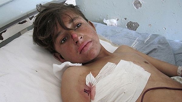 Afgański chłopiec ranny w ataku NATO