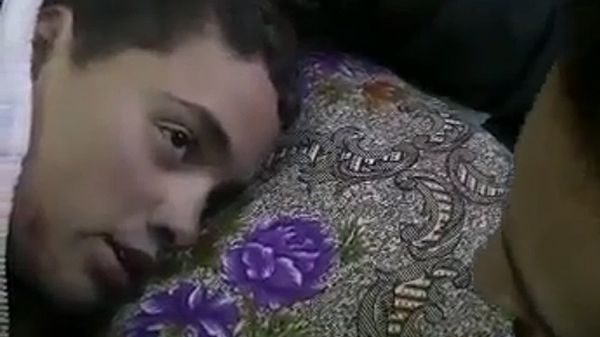 Ranny chłopiec, którzy przeżył masakrę