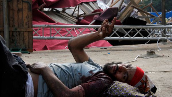 Mężczyzna ranny podczas pacyfikacji obozów zwolenników Mursiego