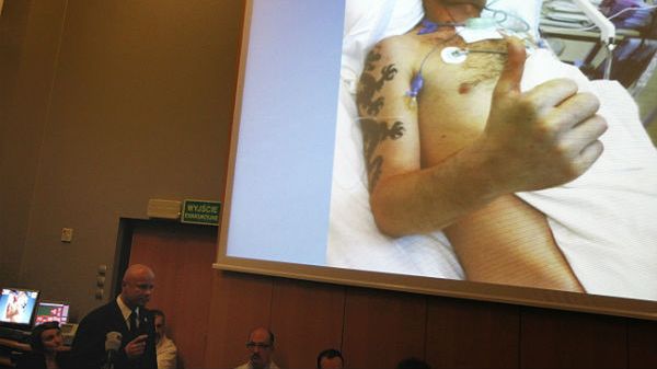 Kierownik zespołu operującego prof. Adam Maciejewski podczas konferencji prasowej nt. pierwszego przeprowadzonego w Polsce przeszczepu twarzy