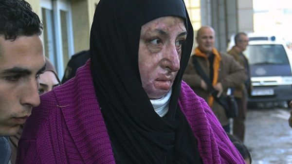 Poparzona Syryjka Manar Almustafa przybyła z 13 członkami rodziny na rehabilitację do hiszpańskiej Malagi