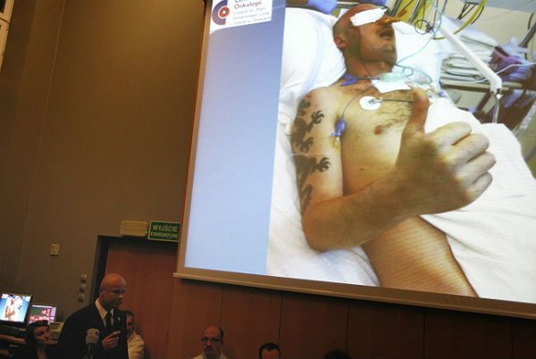 Kierownik zespołu operującego prof. Adam Maciejewski podczas konferencji prasowej nt. pierwszego przeprowadzonego w Polsce przeszczepu twarzy