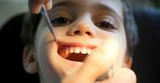 Czarne zęby u dzieci to plaga