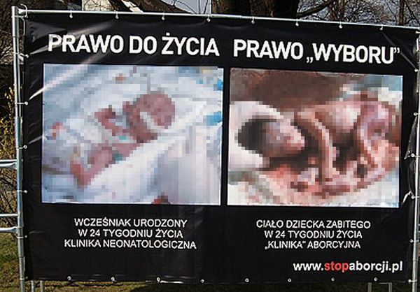 Prezydent Bydgoszczy nakazał usunięcie wystawy o aborcji