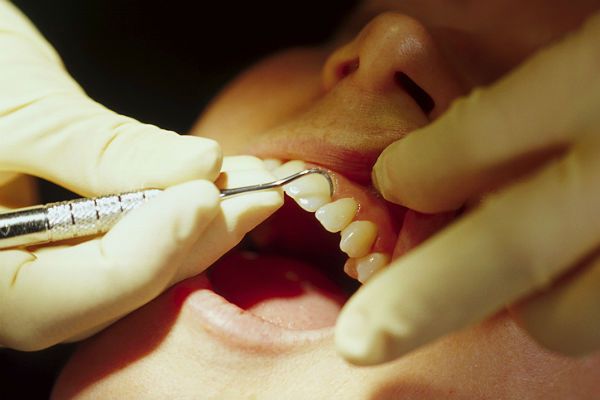 Pijany dentysta w Radomsku - wyrwał pacjentowi zęba
