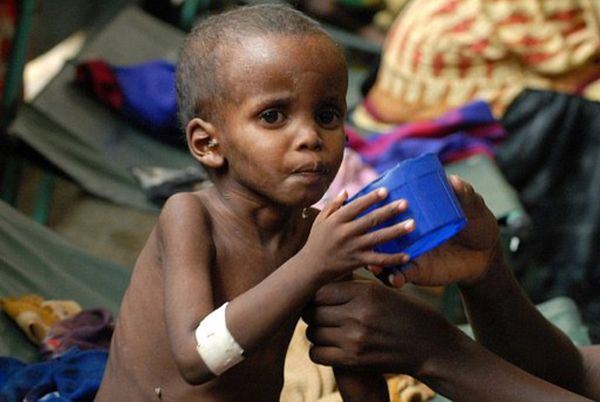 Przerażający bilans klęski głodu w Somalii - 260 tys. zmarłych, połowa to małe dzieci