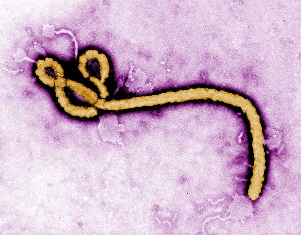 Już 59 ofiar gorączki krwotocznej Ebola w Gwinei