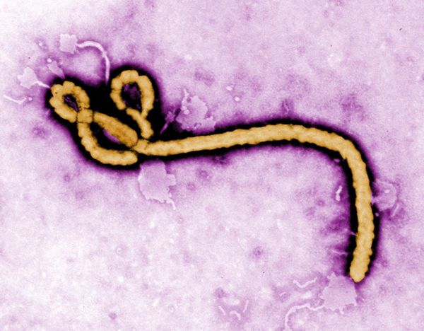 Liberia otrzyma eksperymentalny lek na ebolę