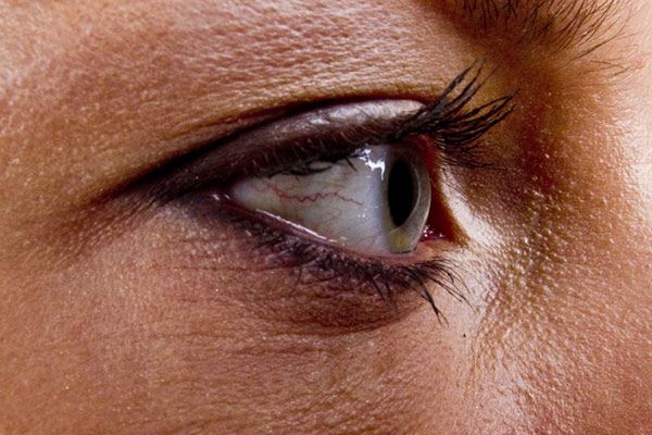 Kolor oczu może określać podatność na choroby