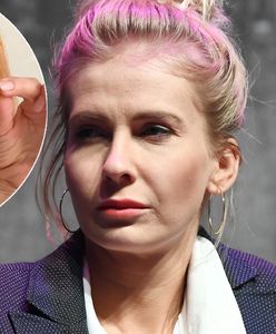 Drastyczna metamorfoza Edyty Pazury. Coś poszło nie tak