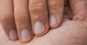 Spójrz na paznokcie. Tak szybko się starzejesz