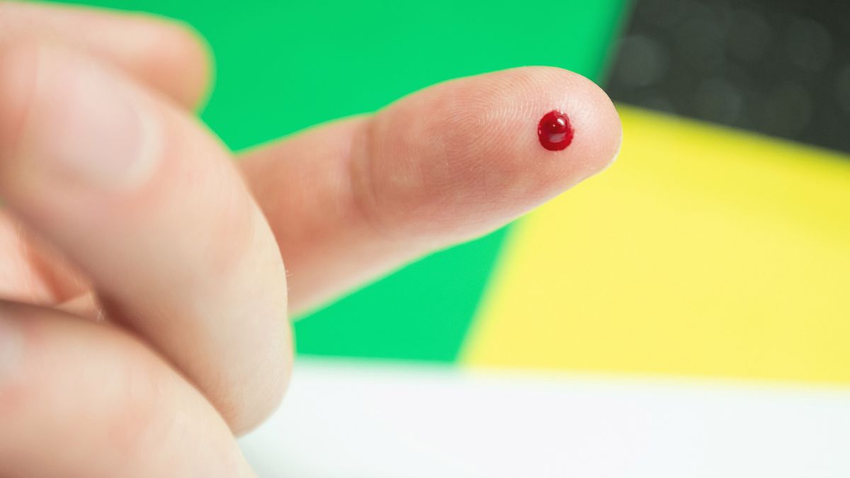 Upuszczanie krwi podczas udaru