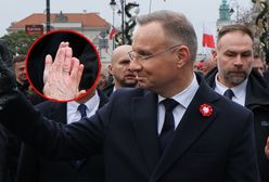 Media pokazały zdjęcie. Tak wygląda ręka Dudy bez opatrunku