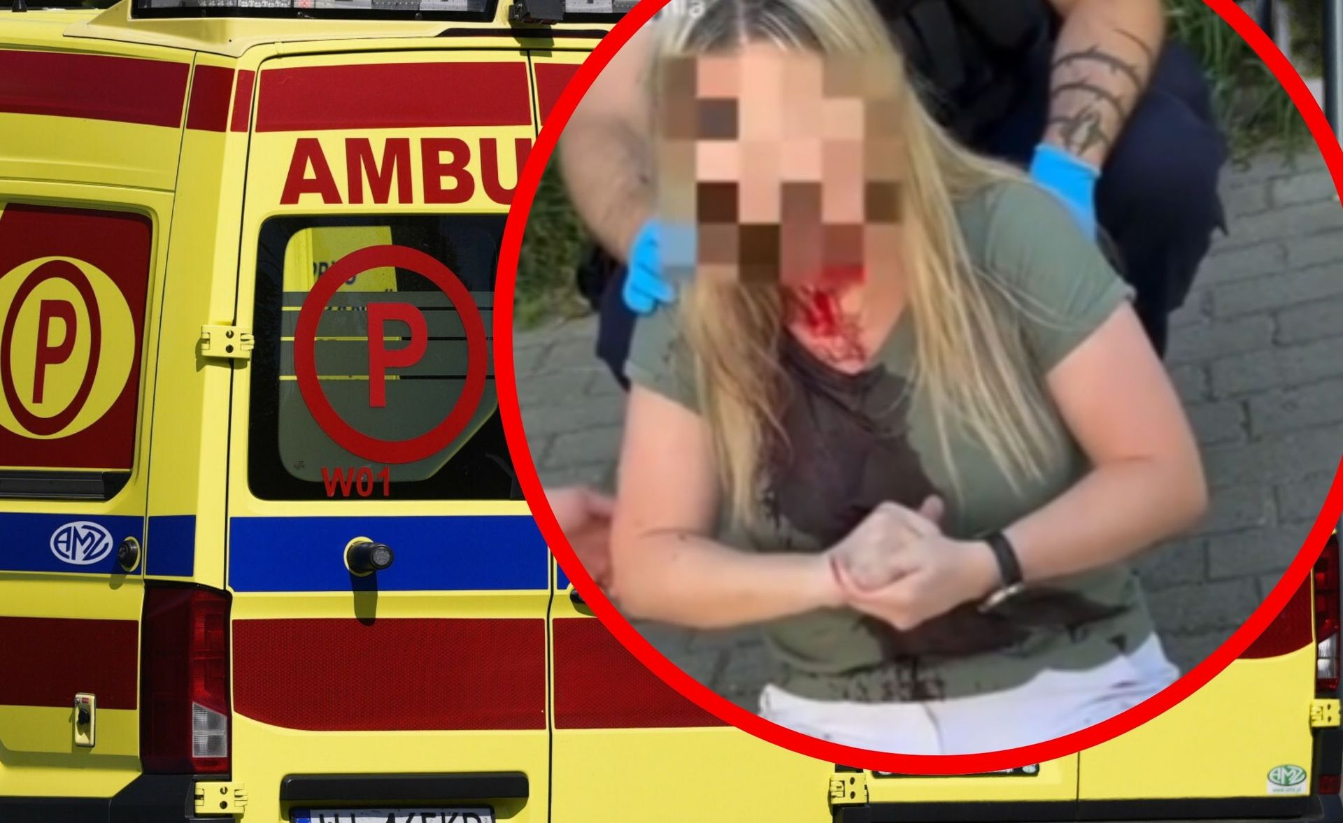 Brutalny atak na kobietę z Ukrainy w Gdyni. realizowane są poszukiwania sprawcy