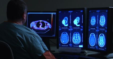 34-latka z parkinsonem