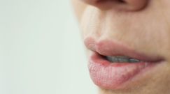 Stres może wpłynąć na zdrowie jamy ustnej