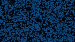 Listerioza  – objawy i leczenie