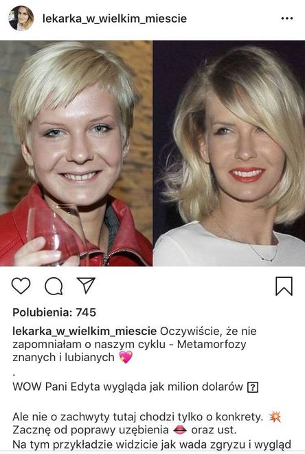 Edyta Pazura przed metamorfozą i po niej. Lekarka wymienia ...